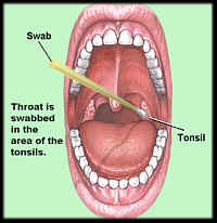 How To Do A Throat Swab 117